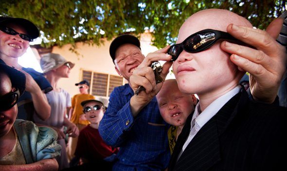 Mirando hacia un futuro mejor. Niños de un refugio para albinos en la cuidada de Shinyanga llevando gafas de sol con las que aliviar el sufrimiento al que siempre están expuestos.  Foto: Liron Shimoni.