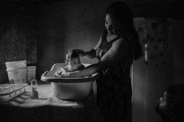 SÃO VICENTE DO SERIDÓ, BRAZIL. Adriana Cordeiro Soares de 30 años baña a su hijo João Miguel de 3 meses que nació con microcefalia causada por le virus Zika. (Foto: Lalo de Almeida)
