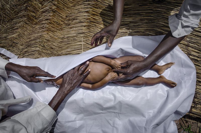 El Imán de la mezquita de Bebedjia prepara el cuerpo sin vida de un bebé de un año para su entierro. Muchos de los niños llegan a los hospitales en condiciones críticas. Los índices de mortalidad infantil, por debajo de los cinco años, en Chad son extremadamente altos. Uno de cada cinco niños morirá antes de cumplir los cinco años. El Sida afecta a 18.000 menores por debajo de los 14 años. Foto: Pep Bonet.
