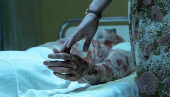 Una de las víctimas de la radiación en la serie 'Chernobyl'.