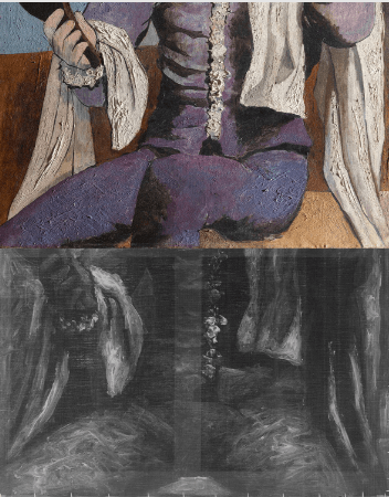 El Arlequín de Picasso antes y después de someterse a una radiografía donde se observa que el pintor se arrepintió de mostrarlo con las piernas abiertas. 